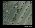 bordetella pertussis